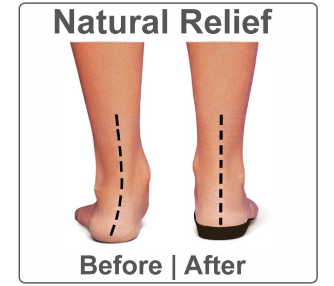 Orthaheel Orthotic Sandals & Insoles properly aligns the lower limbs
